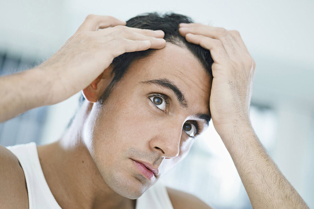 man with hands on his hair trying to understand hair loss